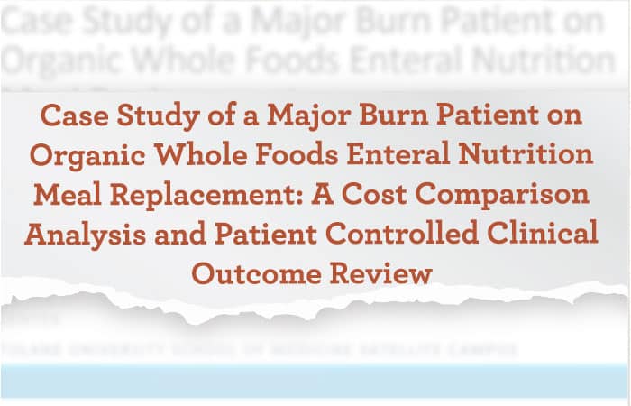 case study on burn patient